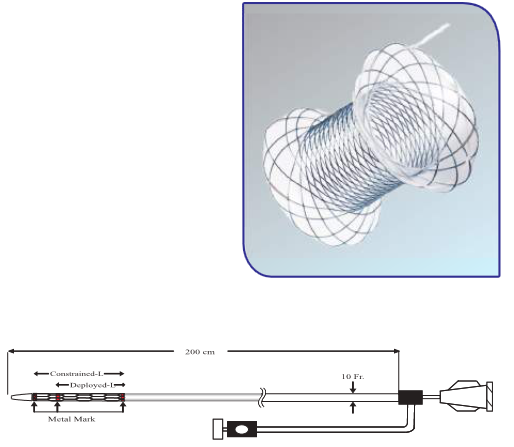 PALLIATOR PSEUDOCYST STENT